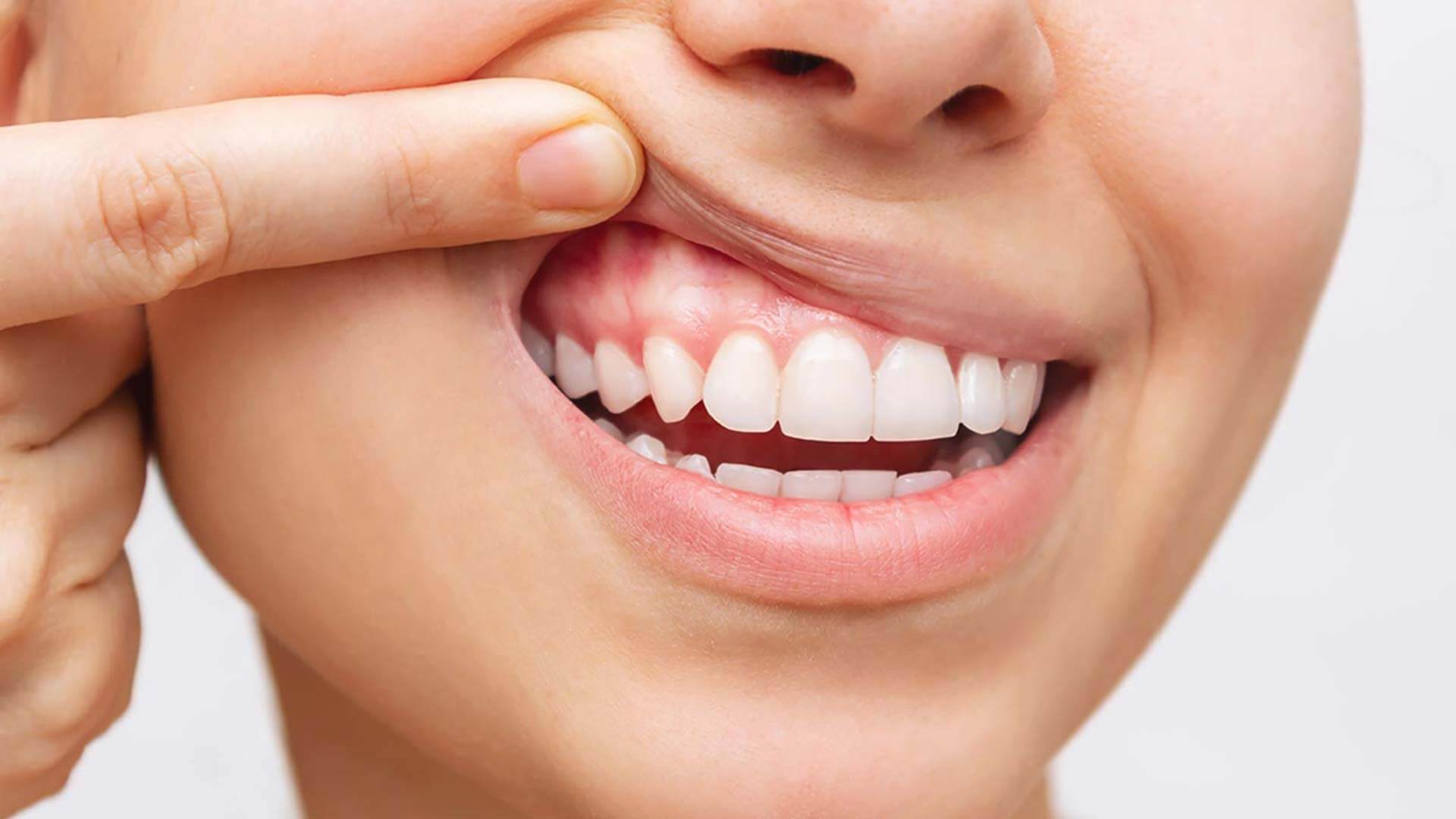 Wurzelbehandlung in der Zahnarztpraxis Are Hilliges in Weissach – moderne Endodontie für den langfristigen Zahnerhalt